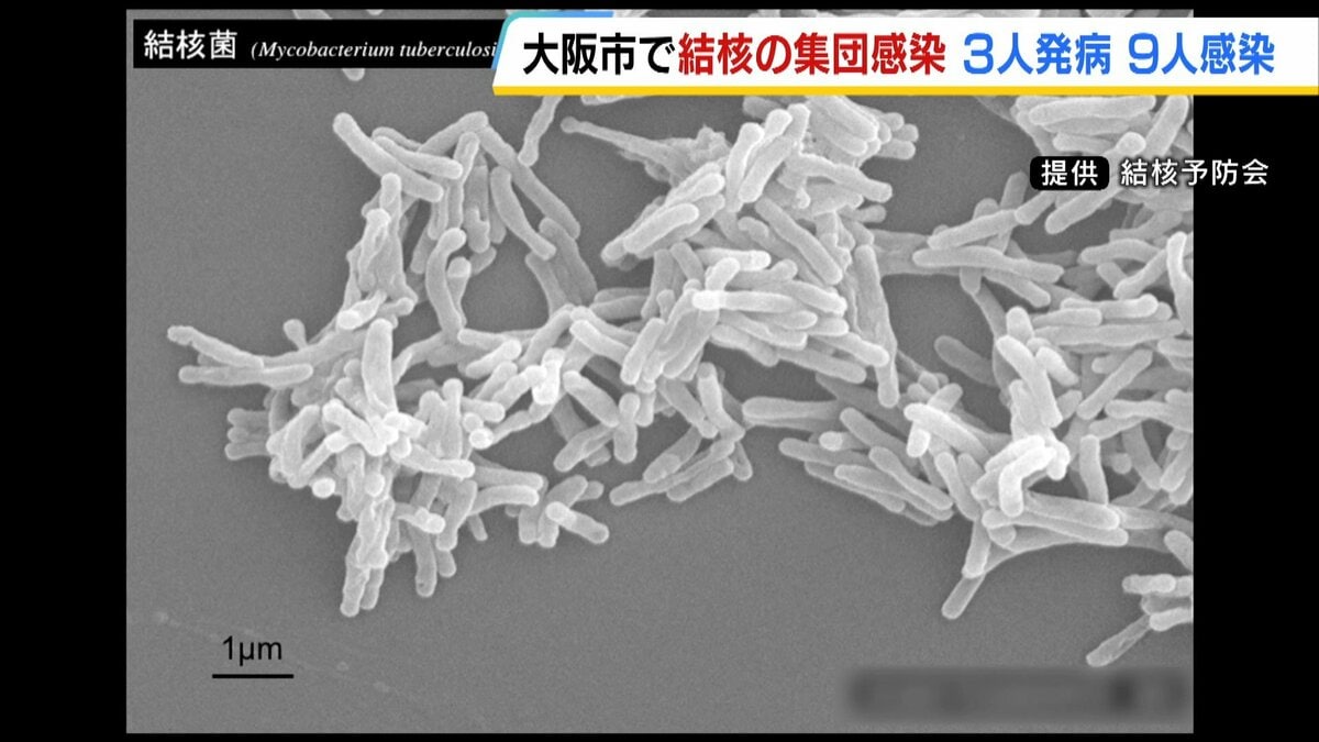 大阪市内で「結核」集団感染 日本語教育機関の関係者ら12人が感染・発病 咳や倦怠感などある場合は早期受診を呼びかけ